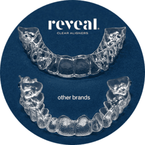 Reveal Clear Aligners versus other brands